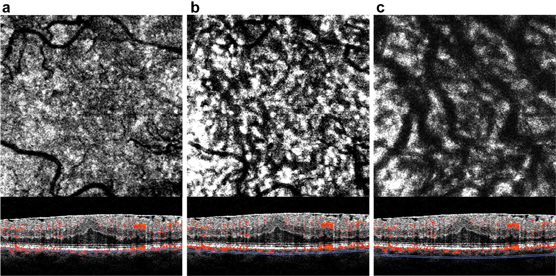 Fig. 1