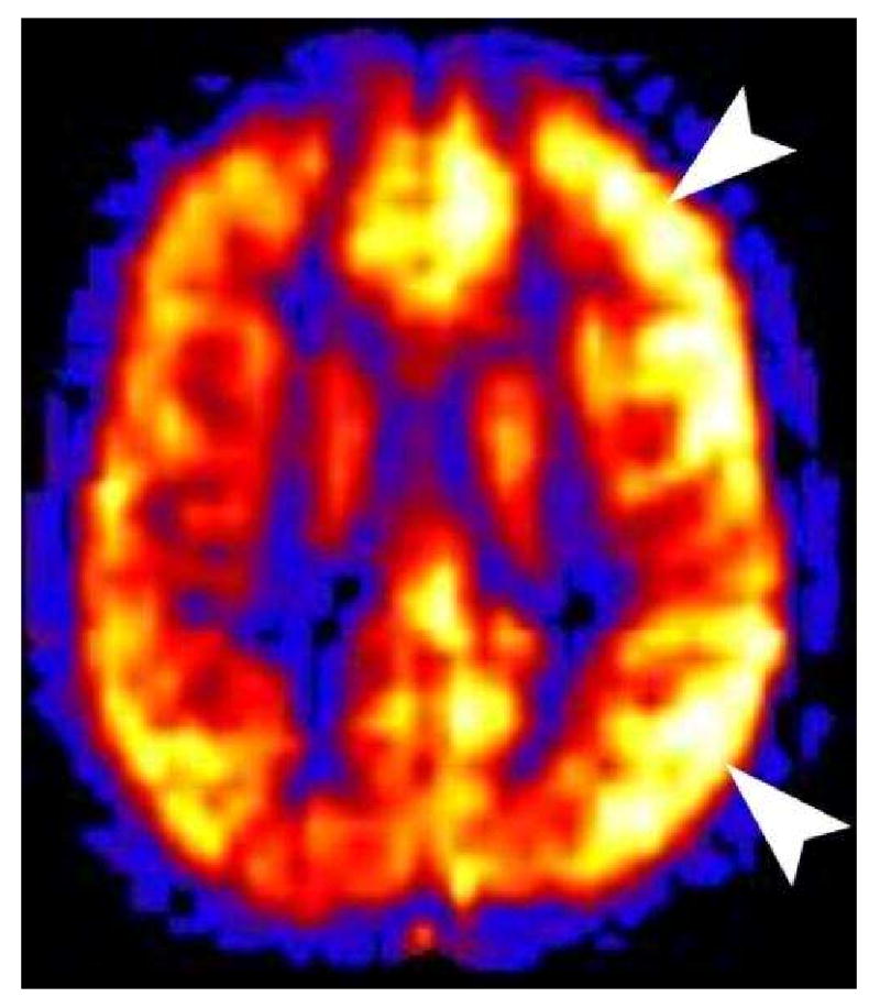 Figure 22