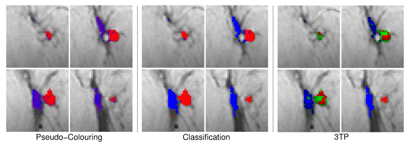 Fig. 11