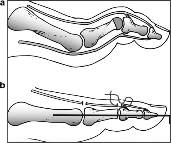 Fig. 7