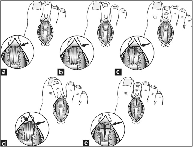 Fig. 12