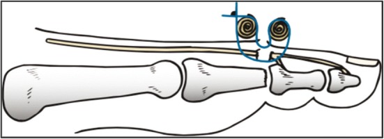 Fig. 6