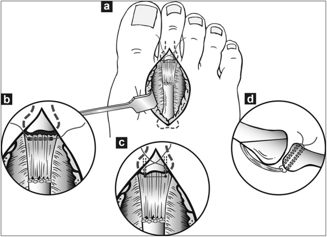 Fig. 13