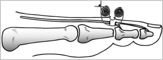 Fig. 2