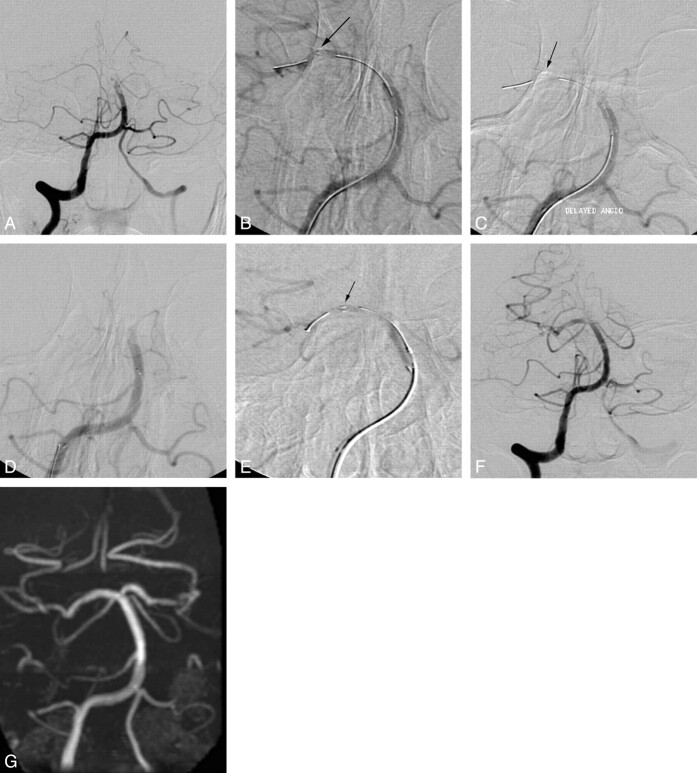 Fig 2.