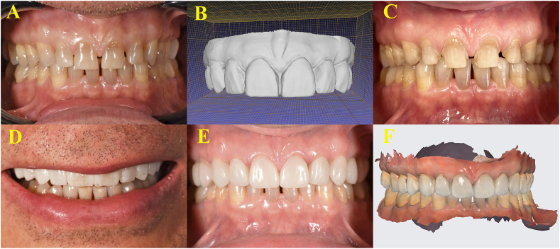 Figure 1