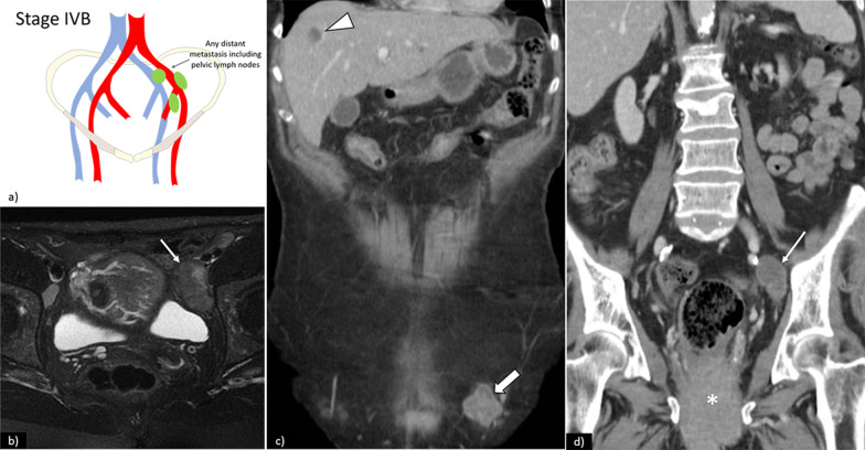 Fig. 11