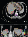 Figure 15: