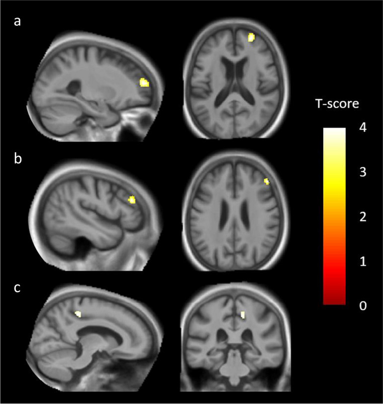 Fig. 3