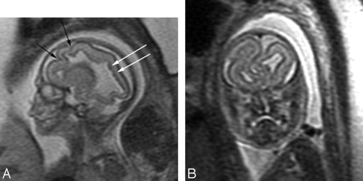 Fig 2.