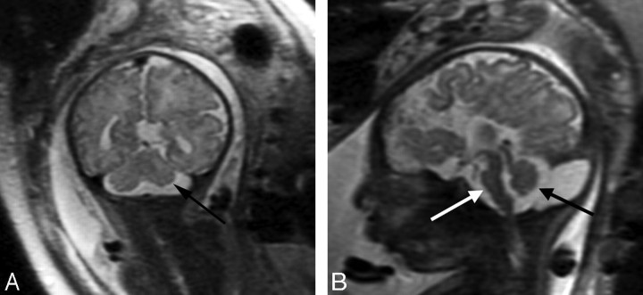 Fig 6.