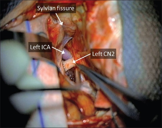 Figure 4