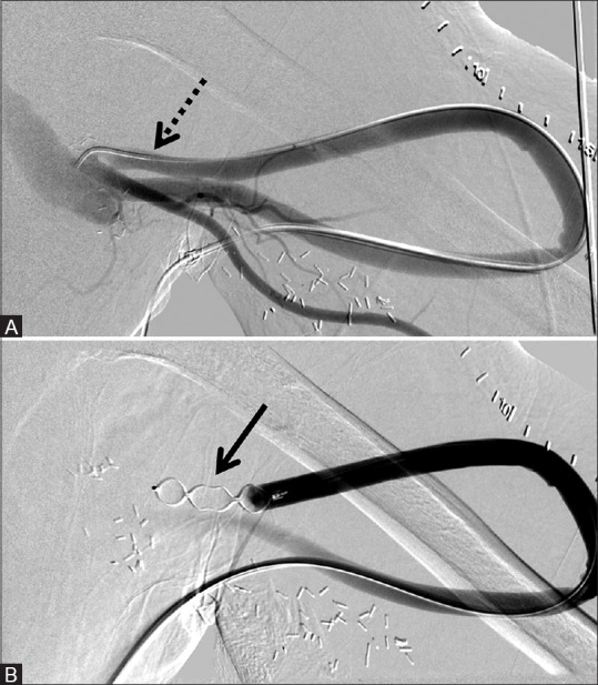 Figure 1 (A and B)