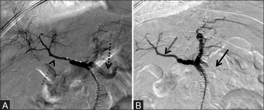 Figure 3 (A and B)