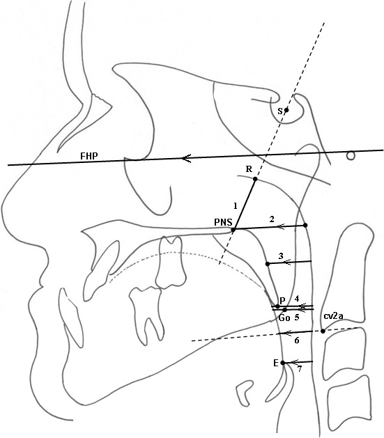 Figure 3. Pharyngeal linear measurements. (1) PNS-R: on the line passing from PNS and R. (2) PPS: palatal pharyngeal distance: on the line passing from PNS, parallel to FHP. (3) SPSS, superior posterior pharyngeal distance: on the line passing from the midpoint of the soft palate, parallel to FHP. (4) MPS, middle pharyngeal distance: on the line passing from P, parallel to FHP. (5) Go-P, gonial pharyngeal distance: on the line passing from Go, parallel to FHP. (6) IPS, inferior pharyngeal distance: on the line passing from cv2a, parallel to FHP. (7) EPS, epiglottic pharyngeal distance: on the line passing from E, parallel to FHP.