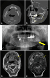 Fig. 7
