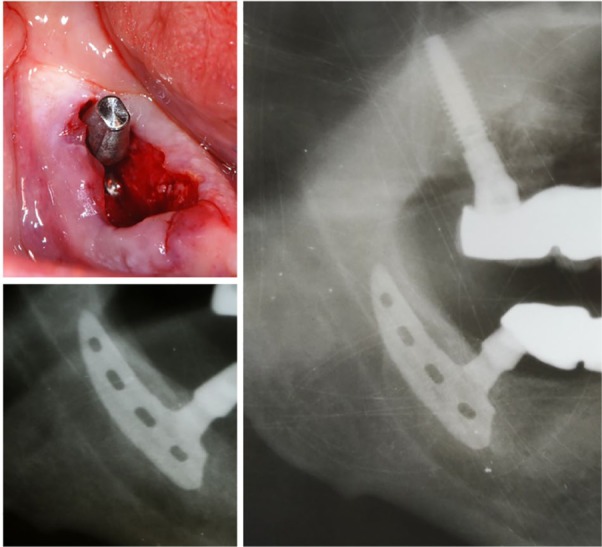 Figure 3.