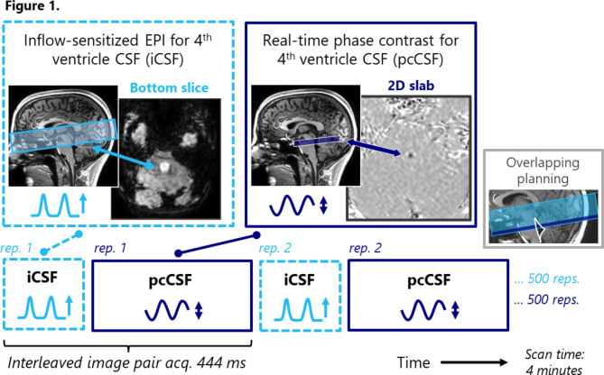 BOLD-CSF dynamics assessed using real-time phase contrast CSF flow ...