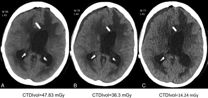 Fig 3.