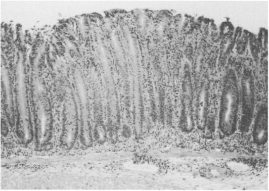 Fig. 39