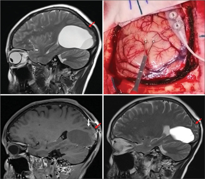 Figure 3: