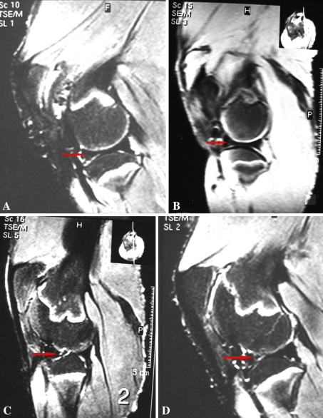 Fig. 5A–D