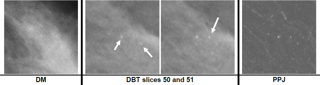 Fig. 10