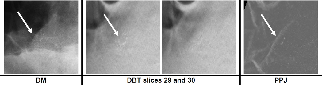 Fig. 11