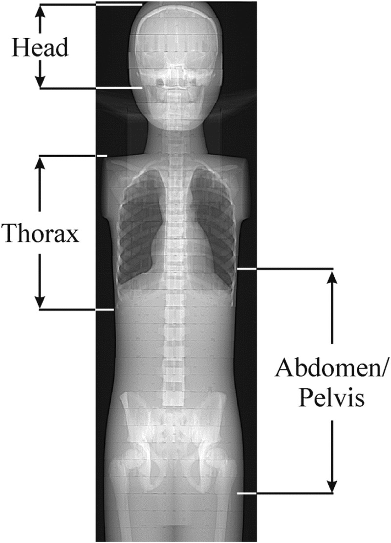 FIGURE 2