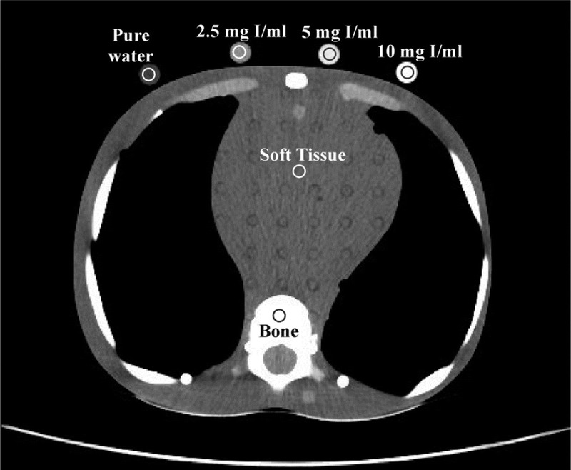 FIGURE 3