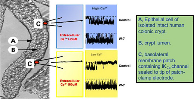 graphic file with name 232_2021_193_Figa_HTML.jpg