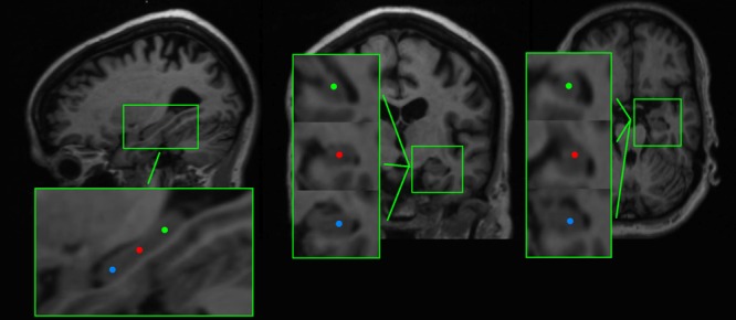 FIGURE 1