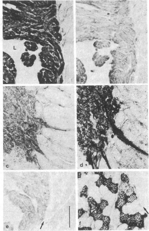 graphic file with name pnas00323-0206-a.jpg