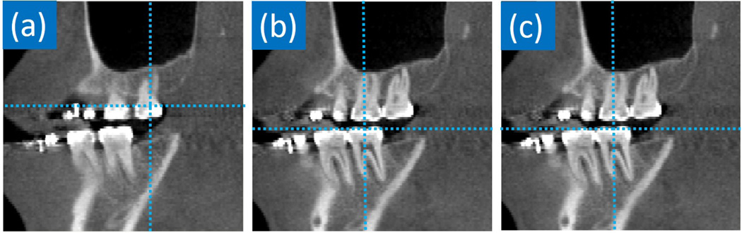 FIG. 11