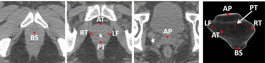 FIG. 6