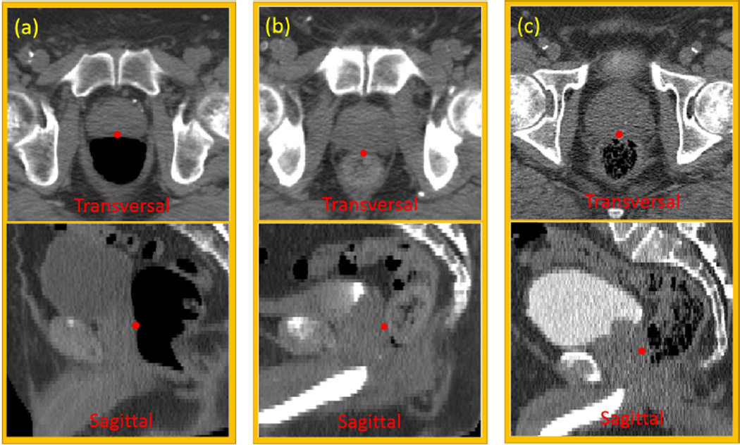 FIG. 1