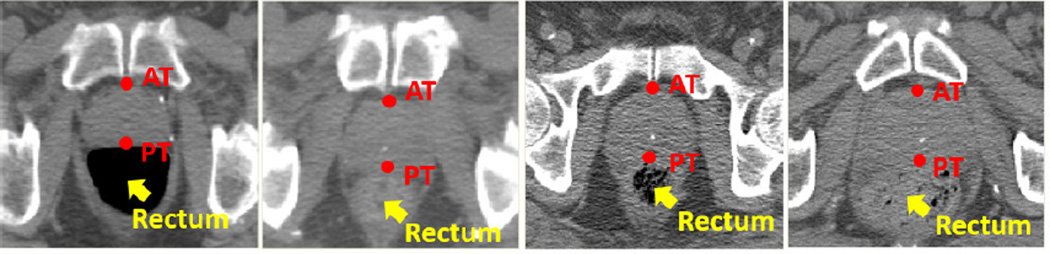 FIG. 7