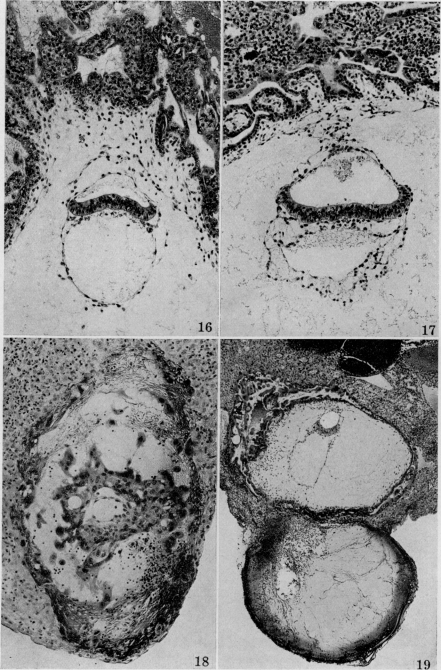 Figs. 16-19