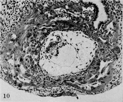 Fig. 10