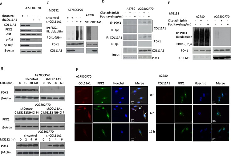 COL11A1 confers chemoresistance on ovarian cancer cells through the ...