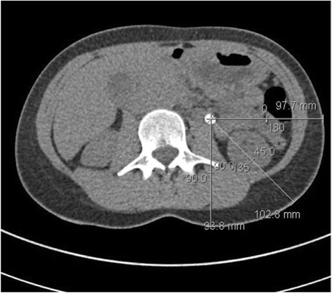 Fig. 2