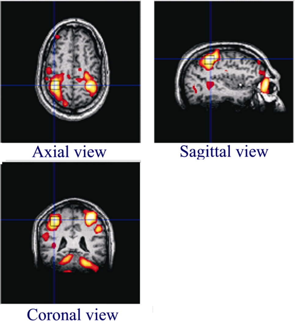 Fig. 1