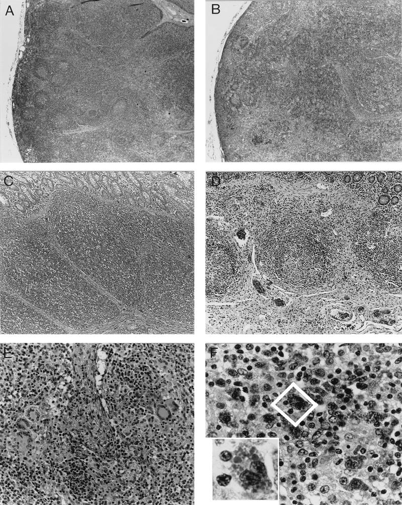 FIG. 1