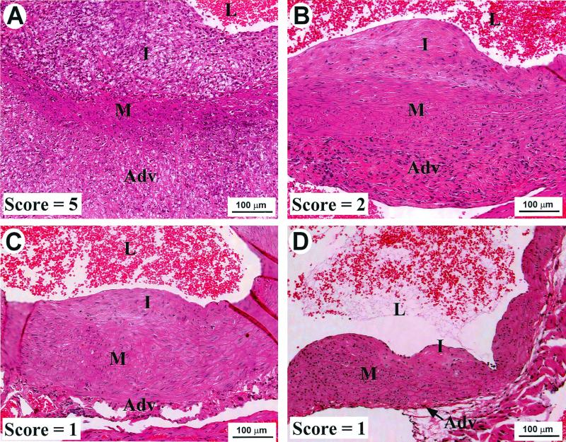 FIG. 4