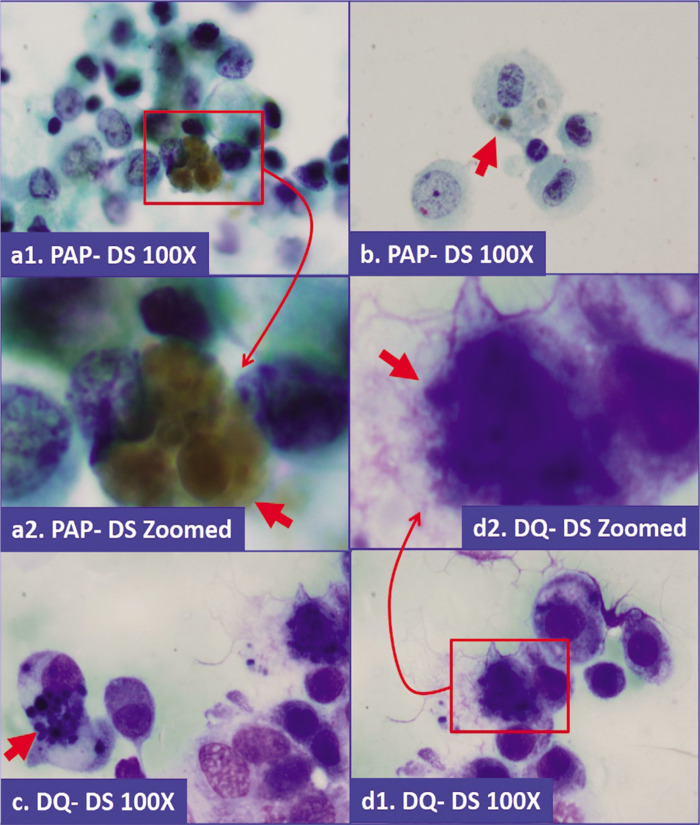 Figure 14