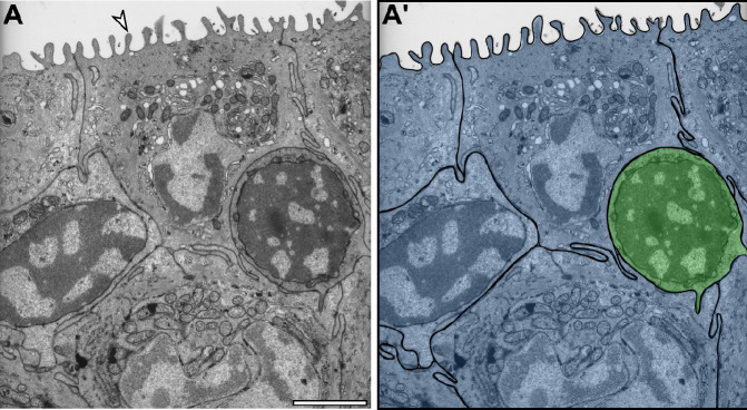 Figure 1—figure supplement 1.