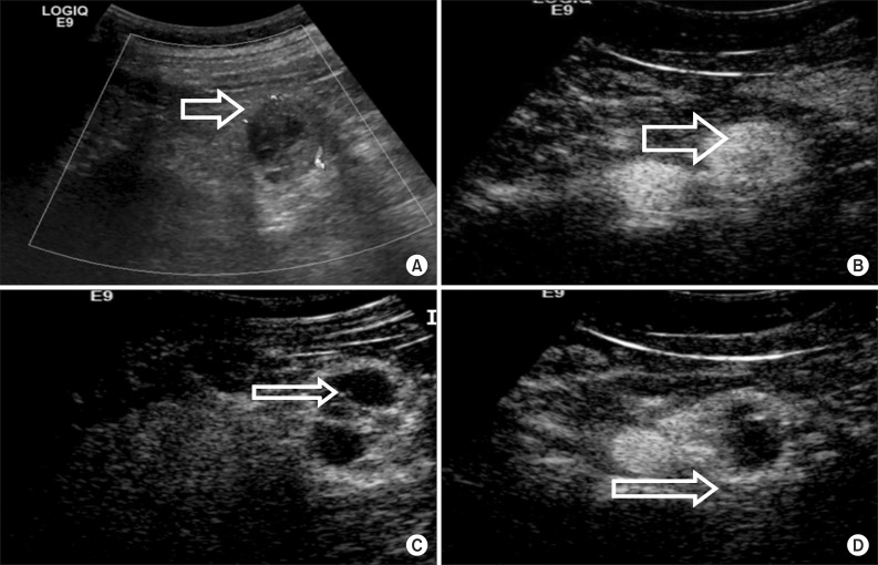 FIG. 1