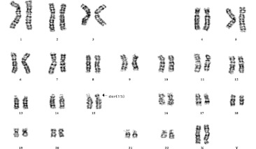 Fig. 1