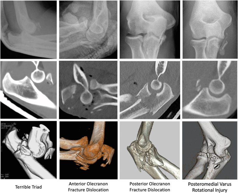 Figure 2