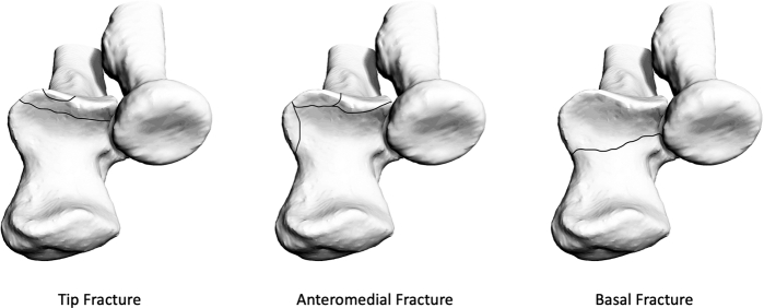 Figure 1